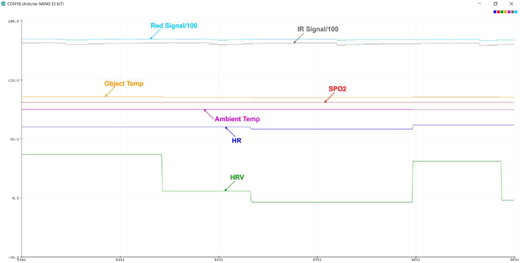 Patient Monitoring System Graph