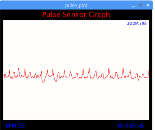 Pulse Sensor Graph of Heartbeat Monitoring System