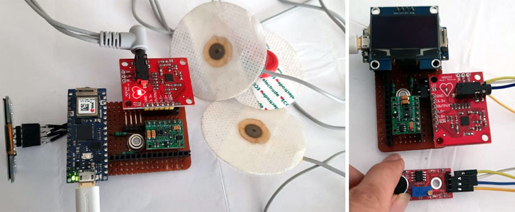 Remote Patient Monitoring System