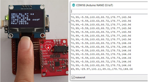 Remote Patient Monitoring