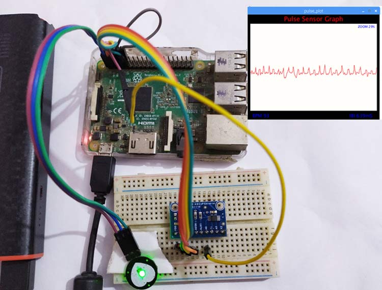 IoT Based Heartbeat Monitoring System using Raspberry Pi